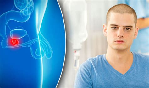 Penile Cancer Men Urged To Note The Signs And Symptoms Of The Disease