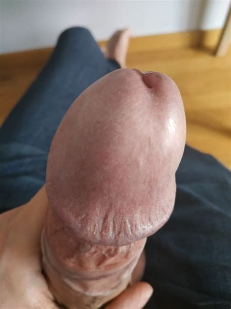Mushroom Head Cock Pics Xhamster Hot Sex Picture