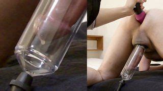 Prostate Milking With Cm Sound Inside Xxx Most Watched Compilations Website