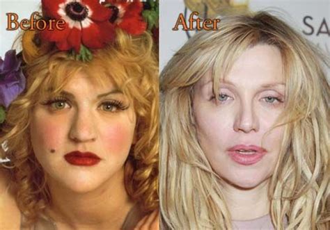 Plastic Surgery Celebrity Surgery Cosmetic Surgery