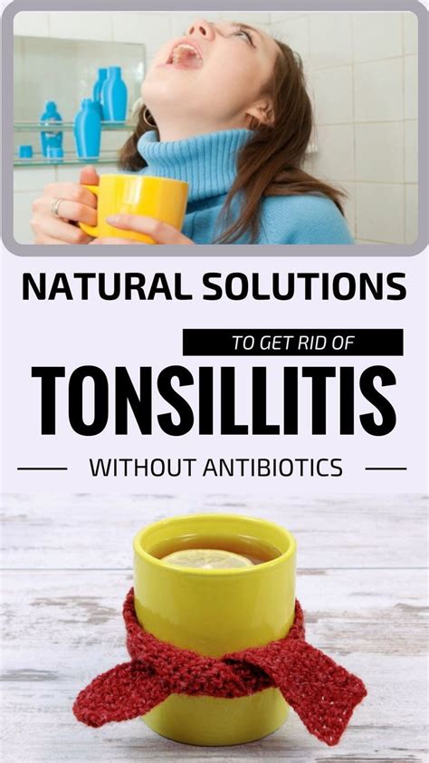 Natural Solutions To Get Rid Of Tonsillitis Without Antibiotics