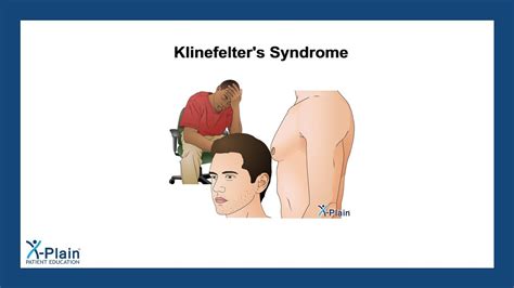 klinefelter s syndrome youtube