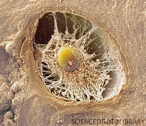 Bone Tissue Colored Sem Of A Section Through An Osteoclast In Bone