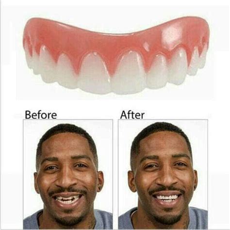 Sebaliknya, gigi palsu yang tidak pas dapat membuat lansia kesulitan makan. Jual gigi palsu perfect smile veneer di lapak amanda shop ...