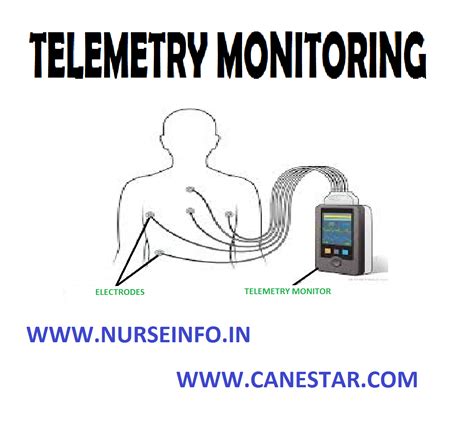 Telemetry Monitoring Nurse Info