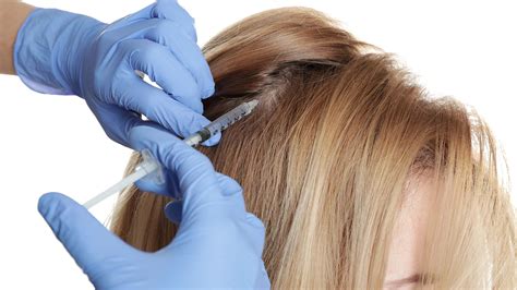 The injectable treatment for wrinkles is applied by considering the naturalness in expression and the ability to maintain a fresh & rejuvenated look without changing any facial features. ARE STEM CELLS INJECTIONS EFFECTIVE FOR HAIR LOSS?