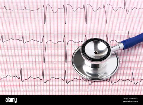 Ecg Test Hi Res Stock Photography And Images Alamy