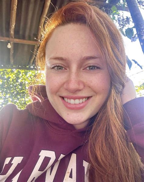 jon on twitter rt frecklesglow like and retweet if you love her freckles