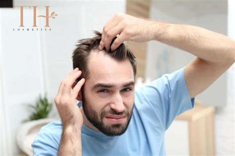 Ultimate Treatment For Male Pattern Baldness Step By Step Guide