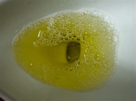 Foamy Urine Vs Normal Urine What Is The Difference By Health Educare