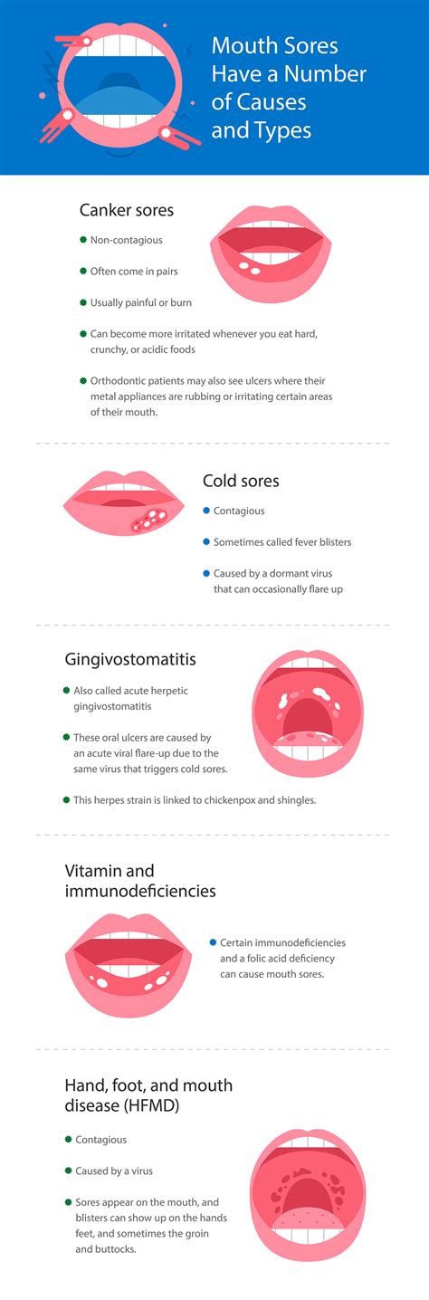 Mouth Sores What They Are And How To Get Rid Of Them Smartmouth