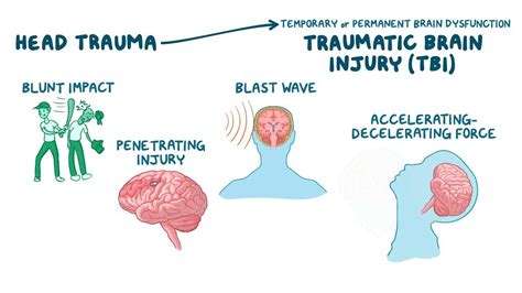 Traumatic Brain Injury Clinical Video And Anatomy Osmosis