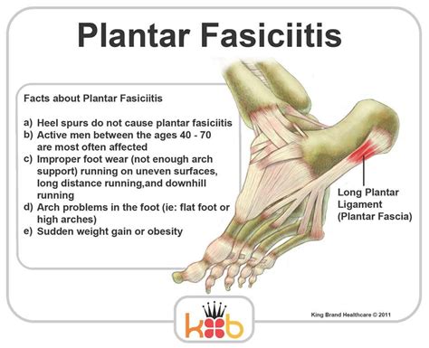 Pin On Plantar Fasciitis