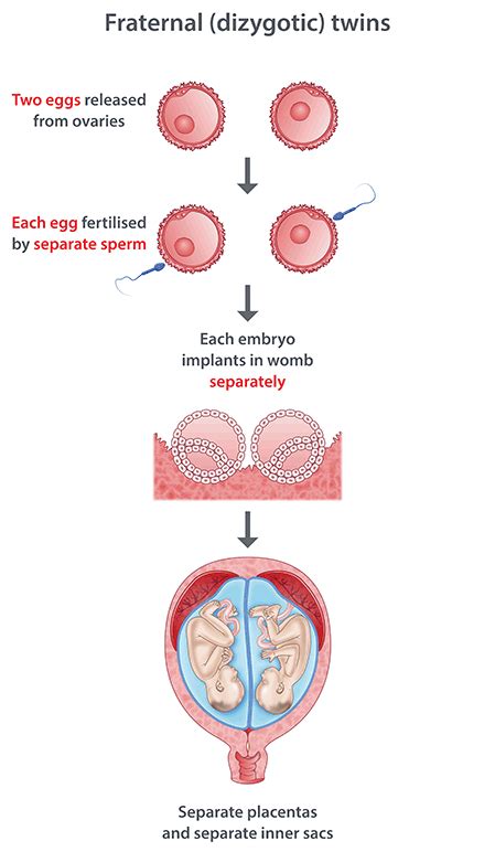 Fraternal Twins Fetal Development