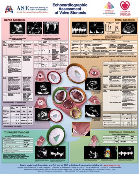 Ase Poster 7 Echocardiographic Assessment Of Valve Stenosis