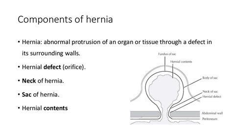 Inguinal And Femoral Hernia