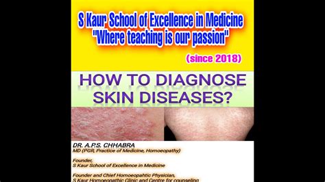 How To Diagnose Skin Diseases Must Watch Till End Made Diagnosis Easy