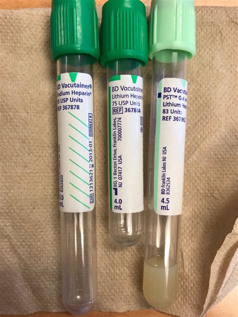Made of a clear polypropylene, supplied capped and labeled, indicating filling line, lot number, and expiry date. David N. Alter MD DABCC🧬 on Twitter: "#PearlOfLabMedicine ...