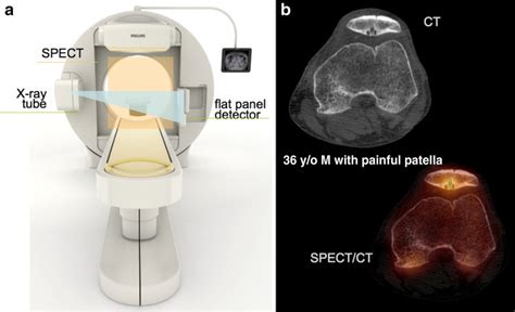 A Spectct Design With Flat Panel Ct For High Resolution Low Dose Ct