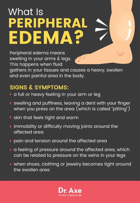 Peripheral Edema Symptoms 7 Natural Treatments Dr Axe