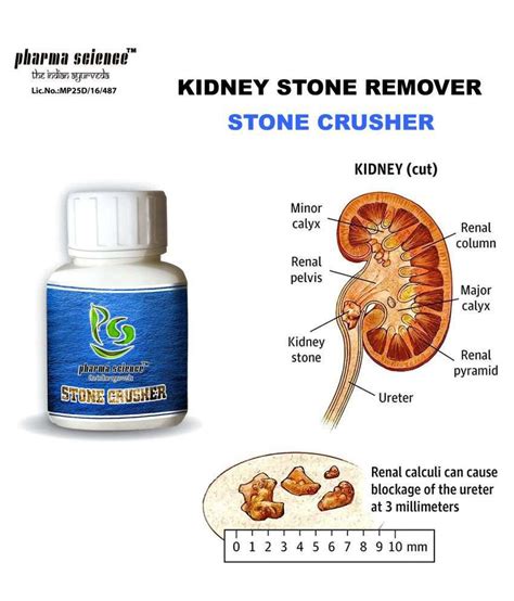 What Is The Medicine For Kidney Stone