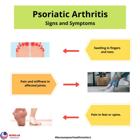 Psoriatic Arthritis Psoriatic Psoriatic Arthritis Arthritis