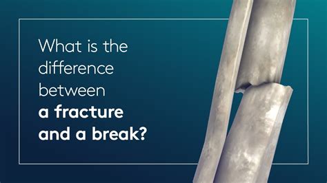 What Is The Difference Between A Fracture And A Break Youtube