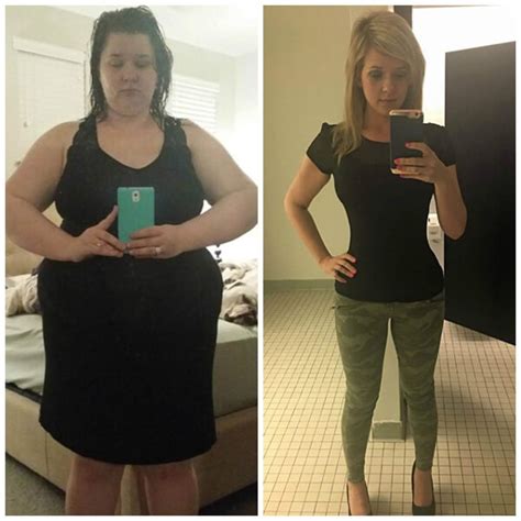 Women Lost A Whopping 125lbs After Gastric Sleeve Surgery