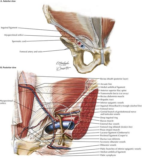 The inguinal canal is a passage in the anterior (toward the front of the body) abdominal wall which in men conveys the spermatic cord and in women the round ligament. Laparoscopic Inguinal Hernia Repair | Basicmedical Key