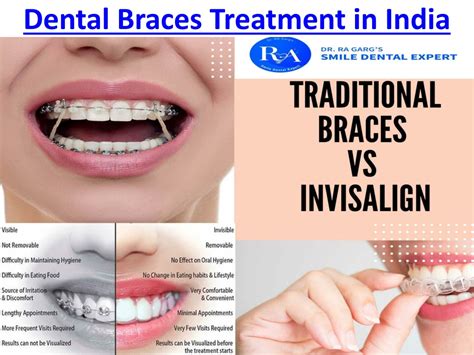 PPT Orthodontic Oral Treatments As Invisible Aligner And Dental Braces Treatment By PowerPoint