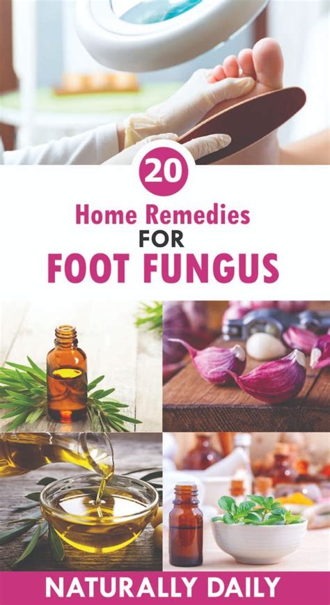 21 Home Remedies For Foot Fungus Nail Fungus Foot Fungus Remedies