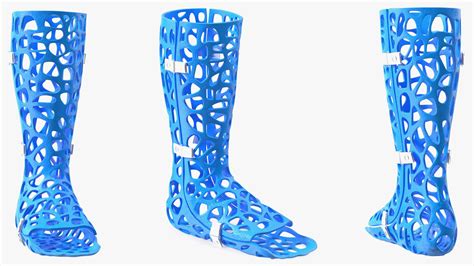 3d Printed Orthopedic Casts Collection 3d Model 69 3ds Fbx Obj