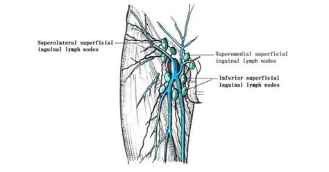 Coronal diagram of the male inguinal anatomy. Inguinal lymph node - www.medicoapps.org