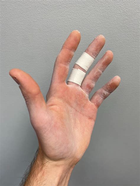 Does Finger Taping Improve Finger Strength In Climbers — Mend
