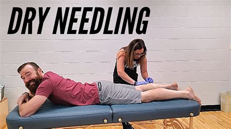 all about dry needling with nicole from mobility athletes youtube