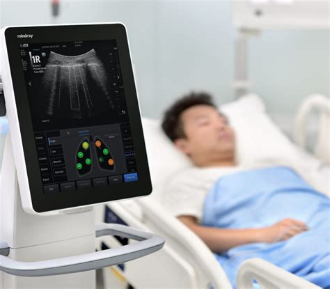 Diagnosing Patients Faster With Pocus Mindray