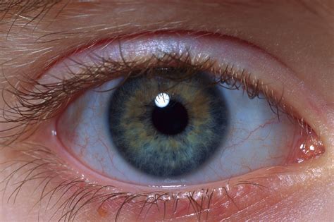 Blind Human Eye Close Up
