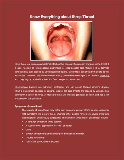 Strep Throat Adult Symptoms Telegraph