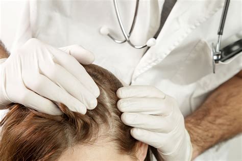Scalp Infections Causes Symptoms And Treatment