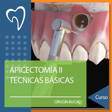 C06 ApicectomÍa Ii TÉcnicas Avanzadas Ons Escuela Digital