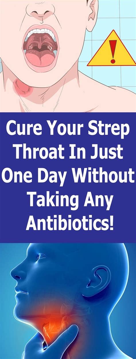 Cure Your Strep Throat In Just One Day Without Taking Any Antibiotics