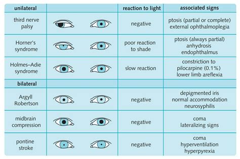 Medical Info Pupillary Abnormalities