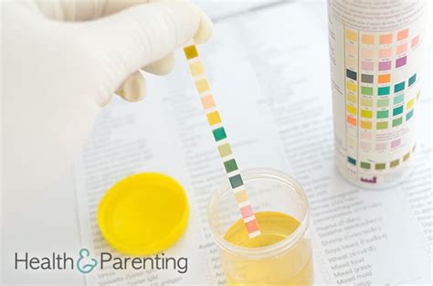 Welche ursachen hat eine blutgerinnungsstörung? Protein in Urine During Pregnancy: What Does it Mean ...