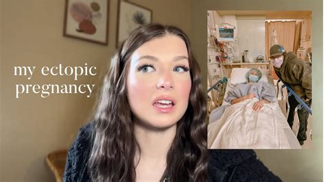 My Ectopic Pregnancy Story Youtube