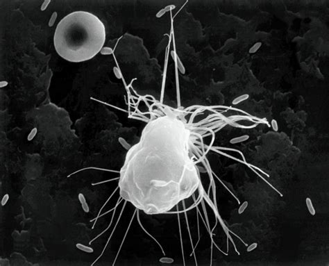Alveolar Macrophage Phagocytosis Of E Coli Photograph By Dennis Kunkel
