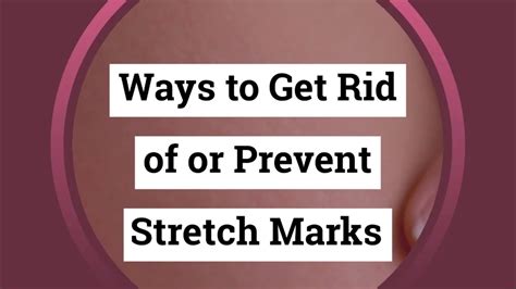 Ways To Get Rid Of Or Prevent Stretch Marks Youtube