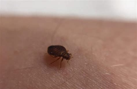 What Do Bed Bugs Look Like Readers Digest