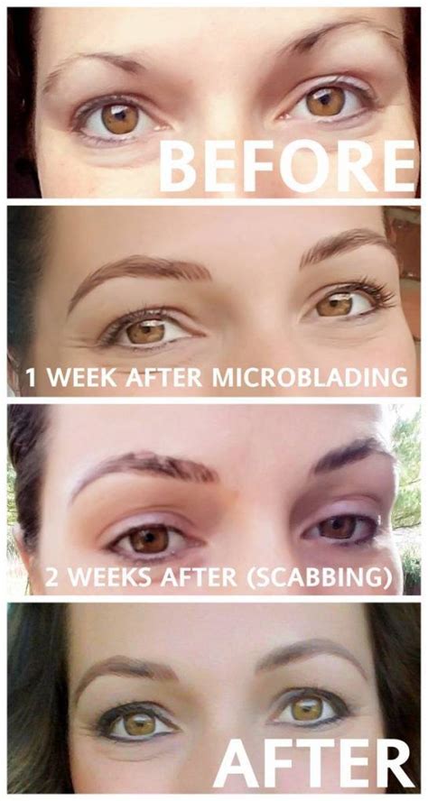 My Microblading Experience In 2020 Microblading Eyebrows After Care