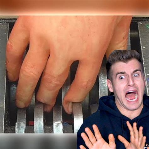 Reaction Time Guy Shreds His Hand Real Or Fake