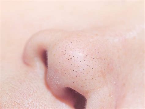 How To Shrink Pores On Nose Get Rid Clean Open Black Pores In Nose